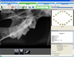 ViewAll 3.2 DICOM Acquisition Software